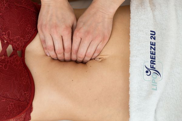 diastasis recti treatment Waltham Forest
