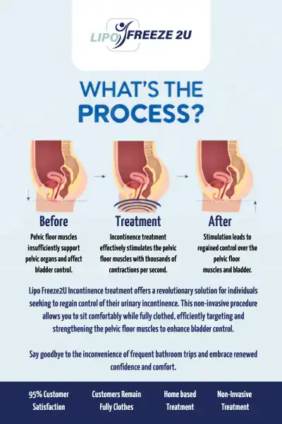 Diagram of how incontinence treatment Waltham Forest works.