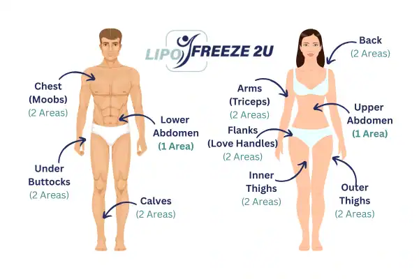 Areas you can have fat freezing treatment Waltham Forest