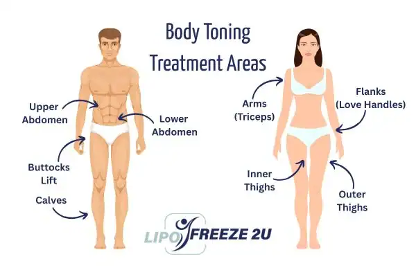 Graphic showing where you can have Body toning Treatment Waltham Forest on your body