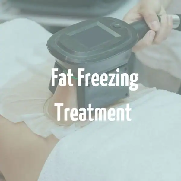 fat freezing treatment Waltham Forest