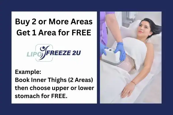 fat freezing prices Waltham Forest