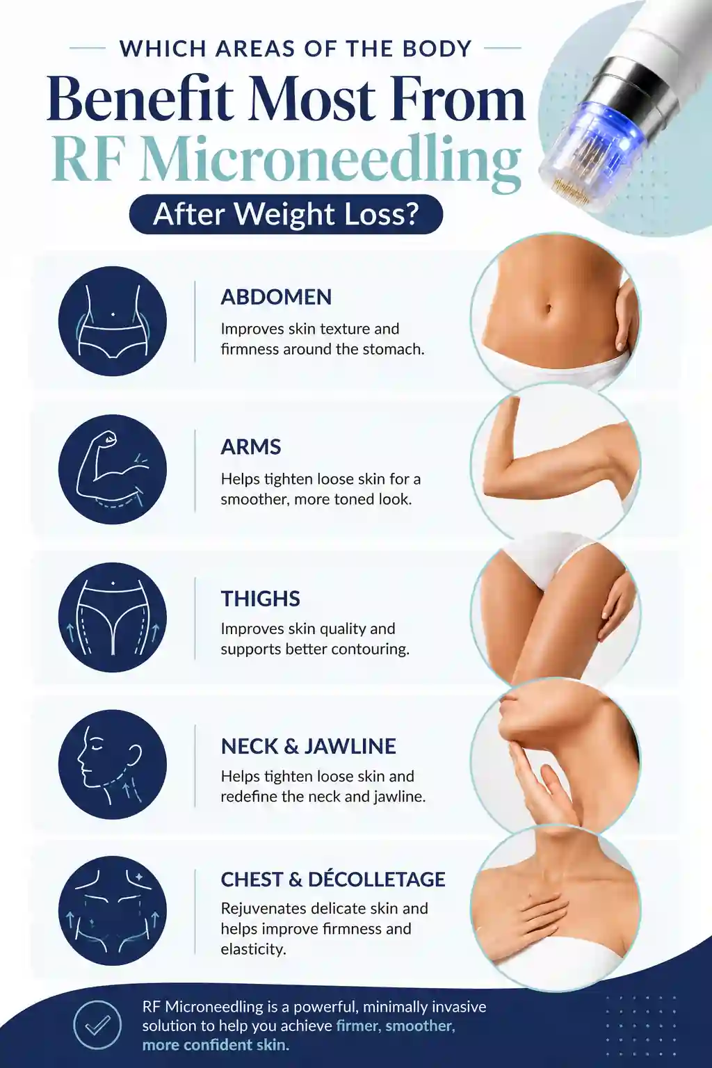 Which Areas of the Body Benefit Most From RF Microneedling After Weight Loss Waltham Forest